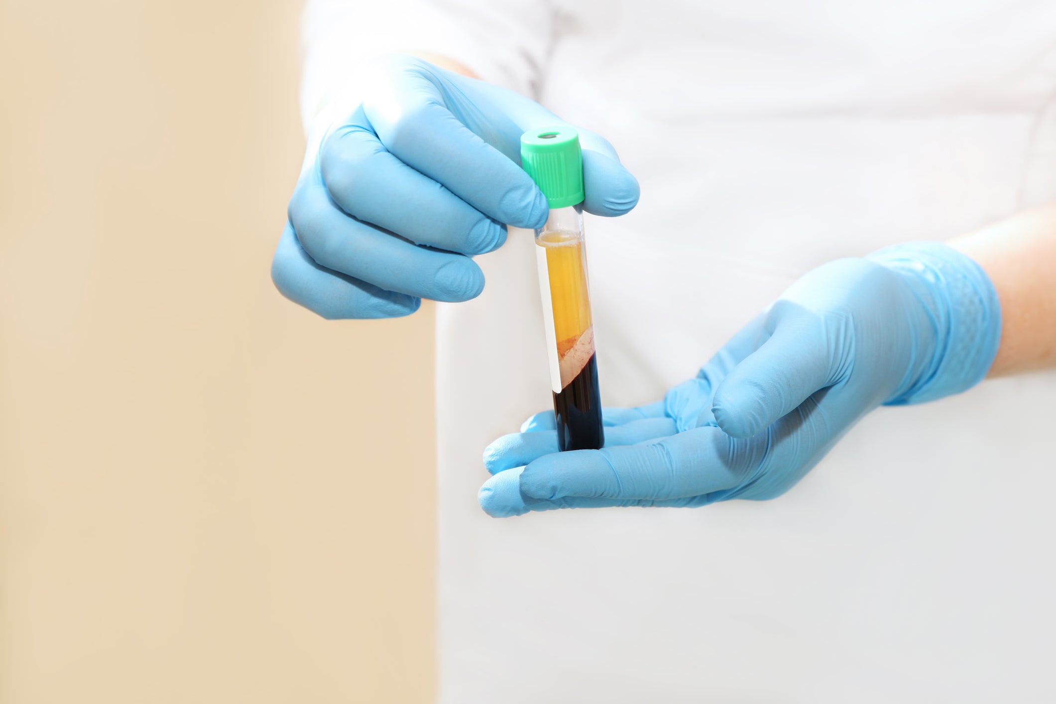 PRP Supplies